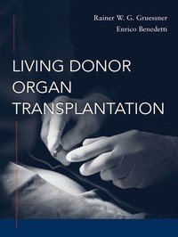 Baixar Living Donor Organ Transplantation pdf, epub, eBook