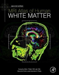 Baixar MRI Atlas of Human White Matter pdf, epub, eBook