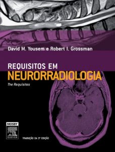Baixar Neuroradiologia pdf, epub, eBook