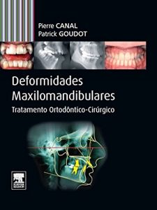 Baixar Deformidades Maxilo-mandibulares pdf, epub, eBook