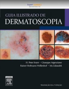 Baixar Guia Ilustrado De Dermatoscopia pdf, epub, eBook