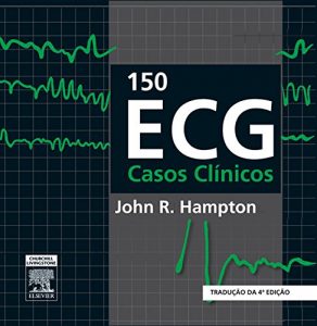 Baixar 150 ECG Casos Clinicos pdf, epub, eBook