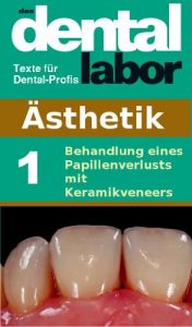Baixar Behandlung eines Papillenverlusts mit Keramikveneers (das dental labor Fachtexte 13) (German Edition) pdf, epub, eBook