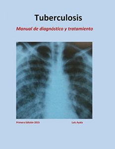 Baixar Tratamiento de Tuberculosis (Spanish Edition) pdf, epub, eBook