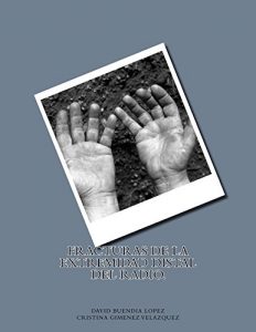 Baixar Fracturas de la extremidad distal del radio. (Spanish Edition) pdf, epub, eBook