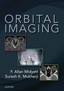 Baixar Orbital Imaging E-Book pdf, epub, eBook