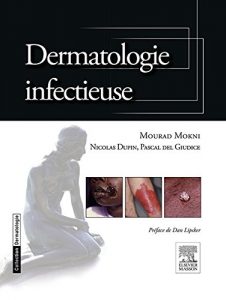 Baixar Dermatologie infectieuse pdf, epub, eBook