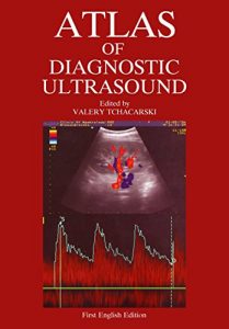 Baixar Atlas of Diagnostic Ultrasound (English Edition) pdf, epub, eBook