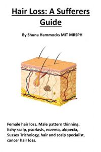 Baixar Hair Loss: A Sufferers Guide: Female hair loss, male pattern thinning, itchy scalp, psoriasis, eczema, alopecia, Sussex Trichology, hair and scalp specialist, cancer hair loss (English Edition) pdf, epub, eBook