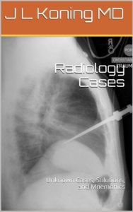 Baixar Radiology Cases (English Edition) pdf, epub, eBook
