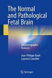 Baixar The Normal and Pathological Fetal Brain: Ultrasonographic Features pdf, epub, eBook
