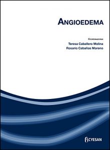 Baixar Angioedema (Spanish Edition) pdf, epub, eBook