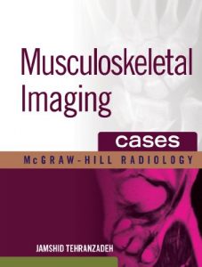 Baixar Musculoskeletal Imaging Cases (McGraw-Hill Radiology) pdf, epub, eBook