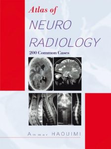 Baixar Atlas Of NEURORADIOLOGY: 200 Common Cases (English Edition) pdf, epub, eBook