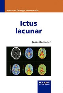 Baixar Ictus lacunar (Spanish Edition) pdf, epub, eBook