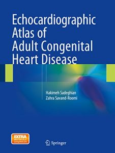 Baixar Echocardiographic Atlas of Adult Congenital Heart Disease pdf, epub, eBook