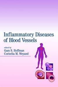 Baixar Inflammatory Diseases of Blood Vessels pdf, epub, eBook