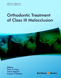Baixar Orthodontic Treatment of Class III Malocclusion (English Edition) pdf, epub, eBook