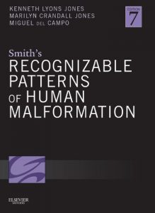 Baixar Smith’s Recognizable Patterns of Human Malformation E-Book pdf, epub, eBook