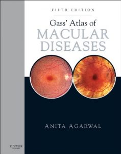 Baixar Gass’ Atlas of Macular Diseases: 1-2 pdf, epub, eBook