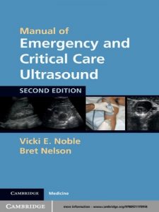 Baixar Manual of Emergency and Critical Care Ultrasound pdf, epub, eBook