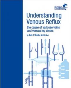 Baixar Understanding Venous Reflux the Cause of Varicose Veins and Venous Leg Ulcers (College of Phlebology Book 1) (English Edition) pdf, epub, eBook