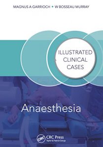 Baixar Anaesthesia: Illustrated Clinical Cases pdf, epub, eBook