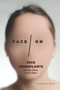 Baixar Face/On: Face Transplants and the Ethics of the Other pdf, epub, eBook