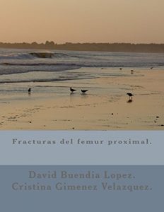 Baixar Fracturas del femur proximal. (Spanish Edition) pdf, epub, eBook