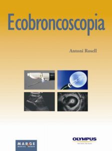 Baixar Ecobroncoscopia (Spanish Edition) pdf, epub, eBook