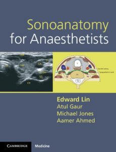 Baixar Sonoanatomy for Anaesthetists (Cambridge Medicine (Paperback)) pdf, epub, eBook