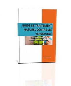 Baixar Guide de traitement naturel contre les vergetures (French Edition) pdf, epub, eBook