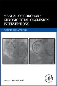 Baixar Manual of Coronary Chronic Total Occlusion Interventions: A Step-by-Step Approach pdf, epub, eBook