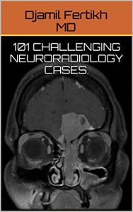 Baixar 101 Challenging Neuroradiology Cases. (English Edition) pdf, epub, eBook
