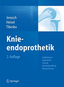 Baixar Knieendoprothetik: Indikationen, Operationstechnik, Nachbehandlung, Begutachtung pdf, epub, eBook
