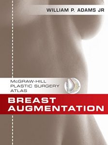 Baixar Breast Augmentation: An Operative Atlas EBOOK (McGraw-Hill Plastic Surgery Atlas) pdf, epub, eBook