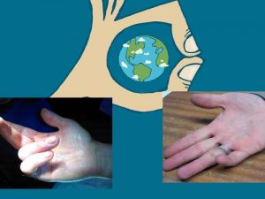 Baixar Wide Awake Hand Surgery 5th Edition (English Edition) pdf, epub, eBook