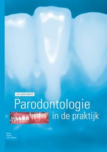 Baixar Parodontologie in de praktijk pdf, epub, eBook