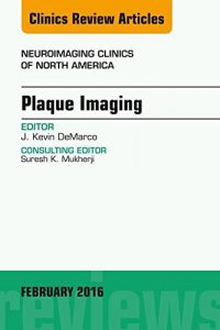 Baixar Plaque Imaging, An Issue of Neuroimaging Clinics of North America, E-Book (The Clinics: Radiology) pdf, epub, eBook