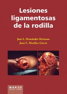 Baixar Lesiones ligamentosas de la rodilla (Spanish Edition) pdf, epub, eBook