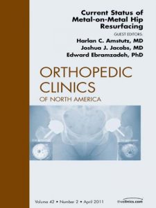 Baixar Current Status of Metal-on-Metal Hip Resurfacing, An Issue of Orthopedic Clinics – E-Book (The Clinics: Orthopedics) pdf, epub, eBook