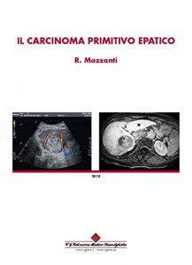 Baixar Il carcinoma primitivo epatico (Italian Edition) pdf, epub, eBook