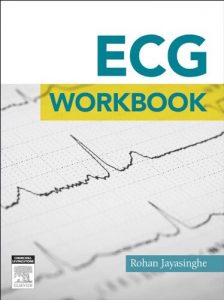 Baixar ECG workbook – E-Book pdf, epub, eBook
