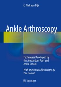 Baixar Ankle Arthroscopy: Techniques Developed by the Amsterdam Foot and Ankle School pdf, epub, eBook
