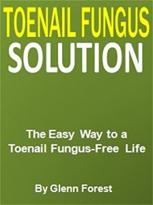 Baixar Toenail Fungus Solution: The Easy Way to a  Toenail Fungus-Free Life (English Edition) pdf, epub, eBook