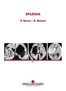 Baixar Epilessia (Italian Edition) pdf, epub, eBook