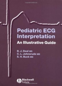 Baixar Pediatric ECG Interpretation: An Illustrative Guide pdf, epub, eBook