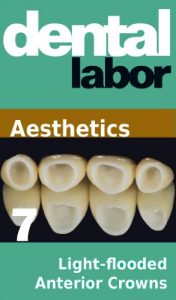 Baixar Light-flooded Anterior Crowns (dental lab technology articles Book 18) (English Edition) pdf, epub, eBook