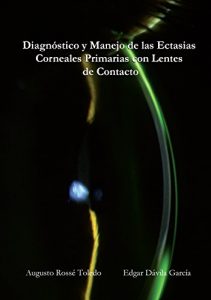 Baixar Diagnostico y Manejo de las Ectasias Corneales Primarias con Lentes de Contacto pdf, epub, eBook