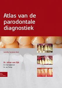 Baixar Atlas van de parodontale diagnostiek pdf, epub, eBook